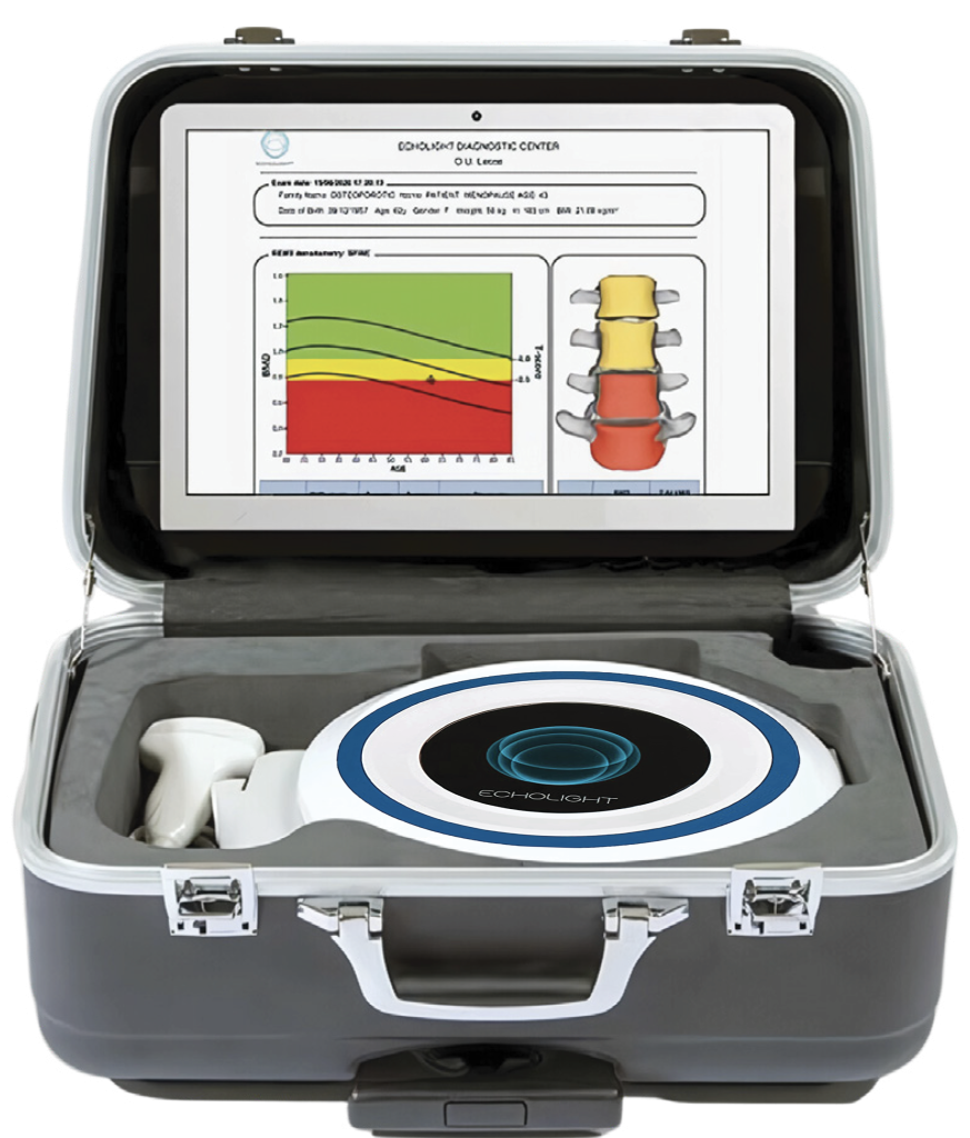 Echolight Scan Bone Health - Sonna Medika Jaya
